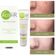 Acnil R Anti Acne Cream Oil Free Non-comedogenic Cream